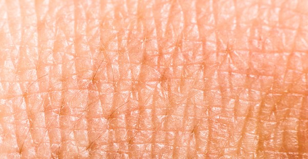 skin dermatitis