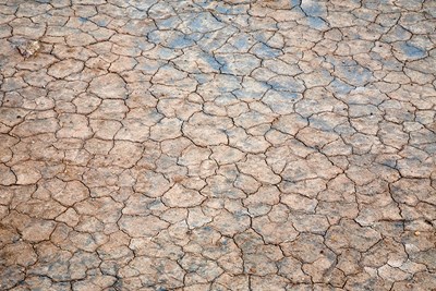 Dry Mouth Causes