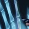 Psoriatic Arthritis Testing and Diagnosis
