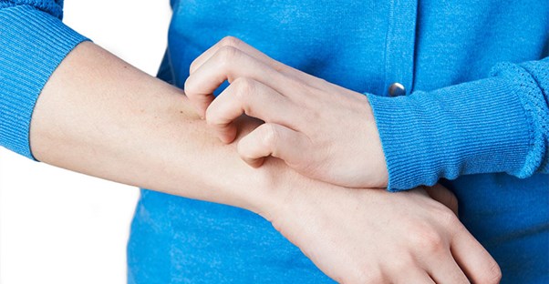 Woman scratching her arm. Psoriasis vs. Eczema