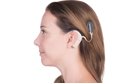 What Is a Cochlear Implant and How Does It Work?