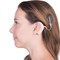 What Is a Cochlear Implant and How Does It Work?