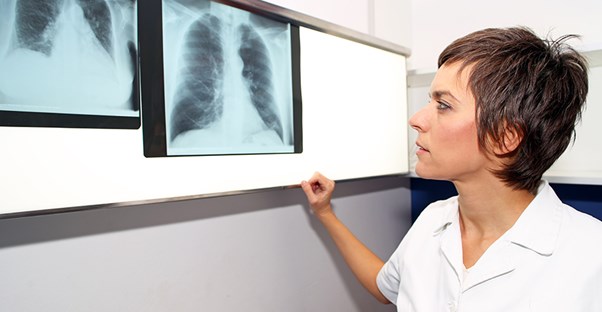 a doctor views a chest xray to diagnose a pulmonary embolism