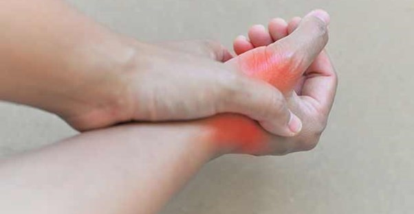 20 Things You Should Know About Gout  main image