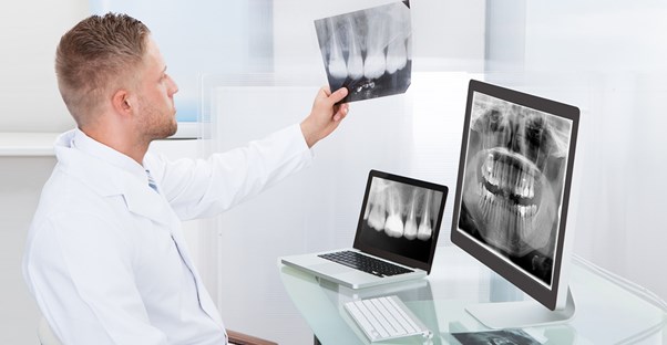a doctor examines an x-ray looking for oral cancer