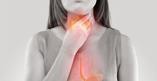 How to Live With Acid Reflux main image