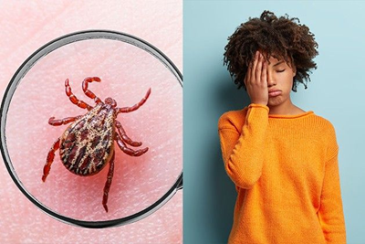 How to Live With Lyme Disease