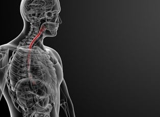 Understanding Barrett's Esophagus