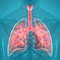 Pneumonia Signs and Symptoms