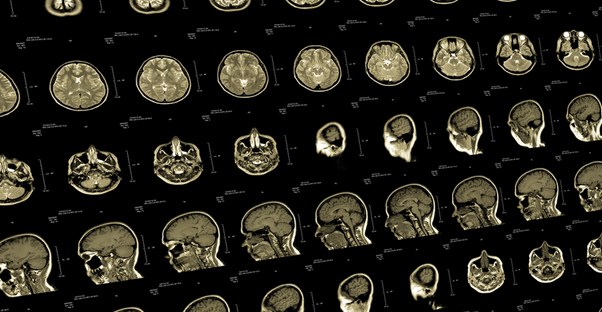 a medical image a doctor is using to treat a concussion