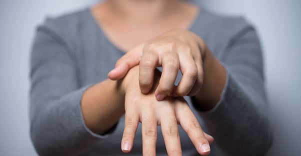 a woman with eczema scratches her hands