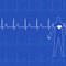 Causes of Atrial Fibrillation