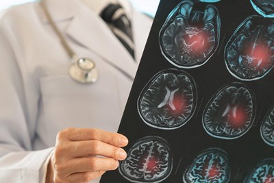 untreated high blood pressure