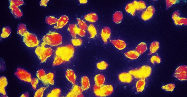 10 Common Parasites You Could Have Right Now