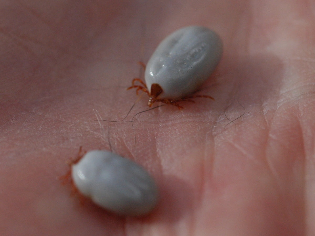 Rickettsia parkeri Rickettsiosis