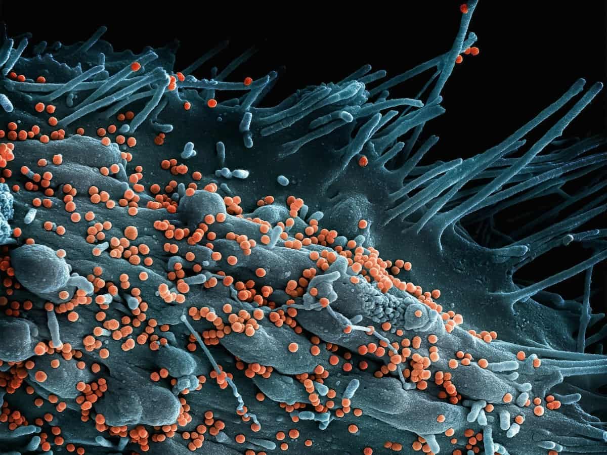 Rocky Mountain Spotted Fever