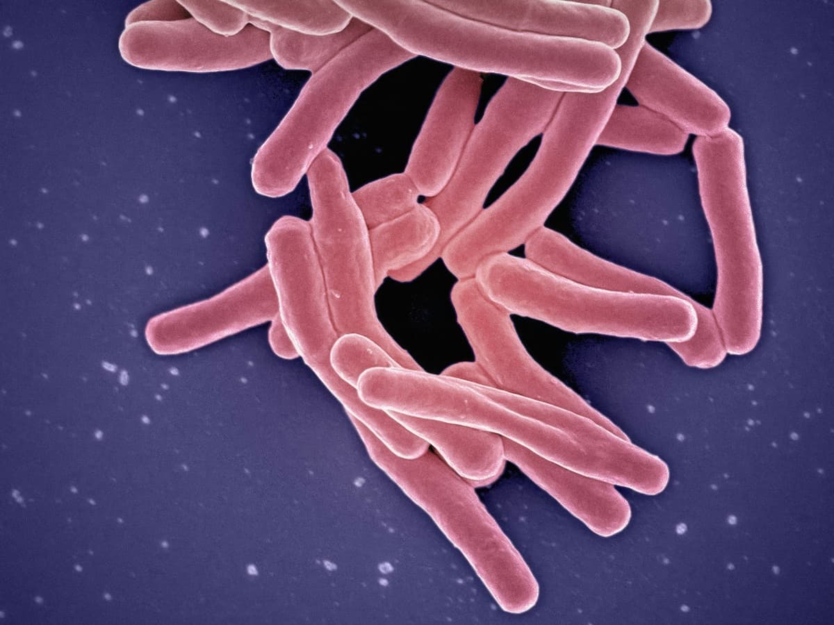Anaplasmosis