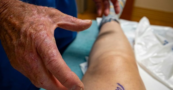 The Difference Between Superficial Clots and DVTs & How Doctors Find Them