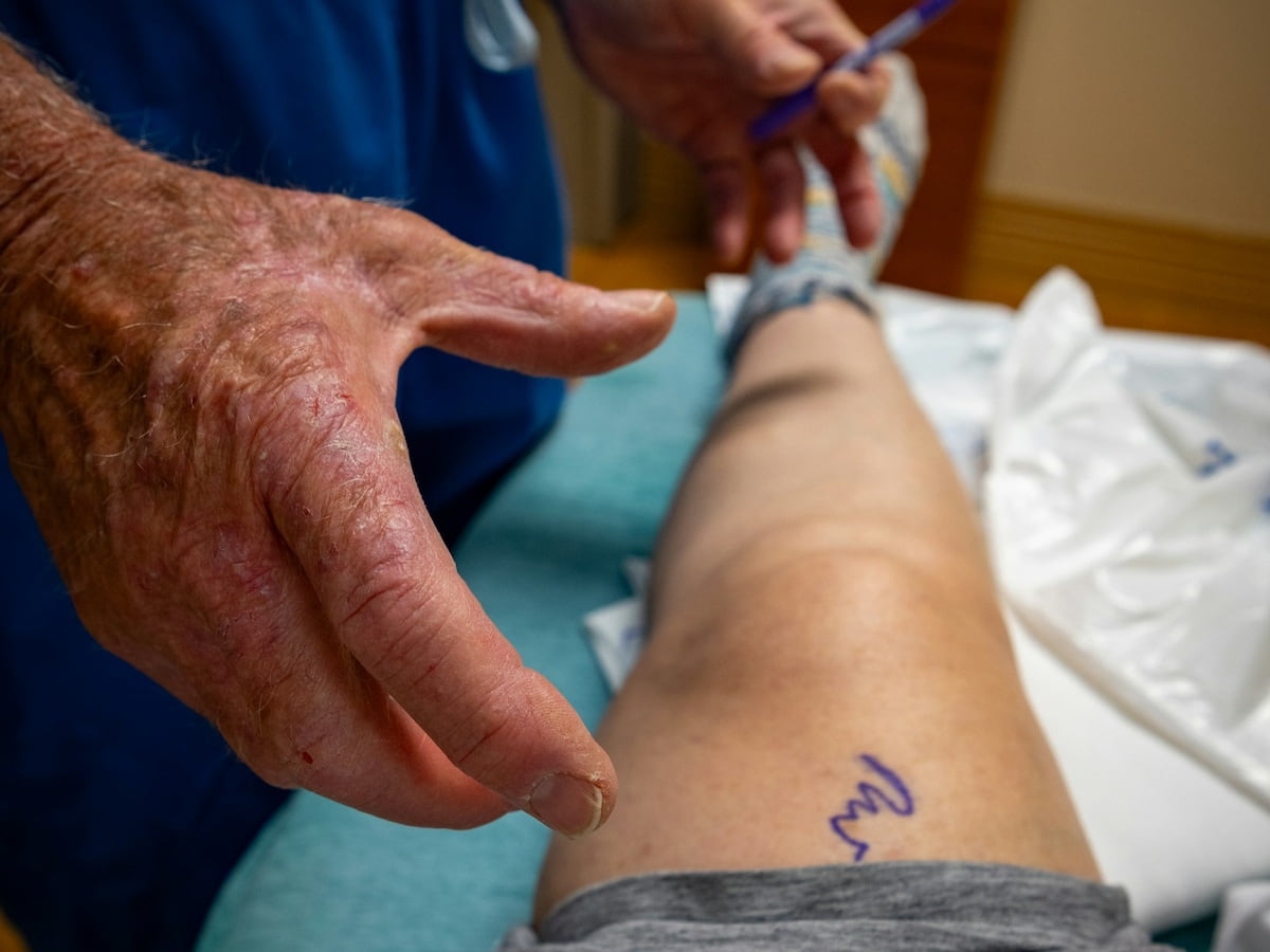 How do regular people usually find out they have a clot? 