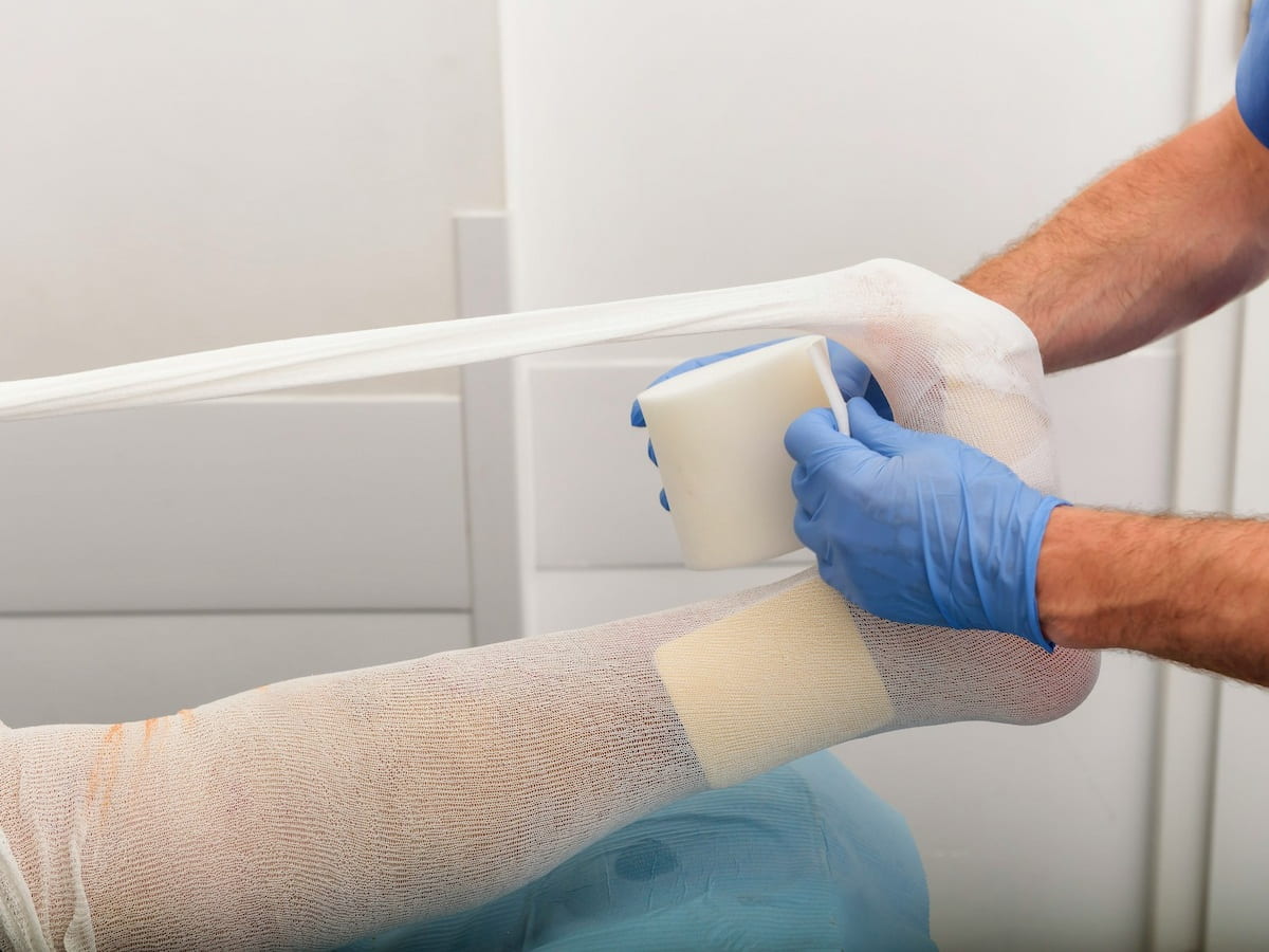Treating a Superficial Clot