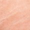 What are Stretch Marks?