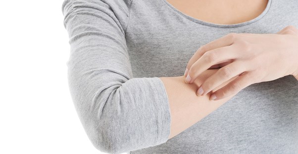 A woman scratching her eczema