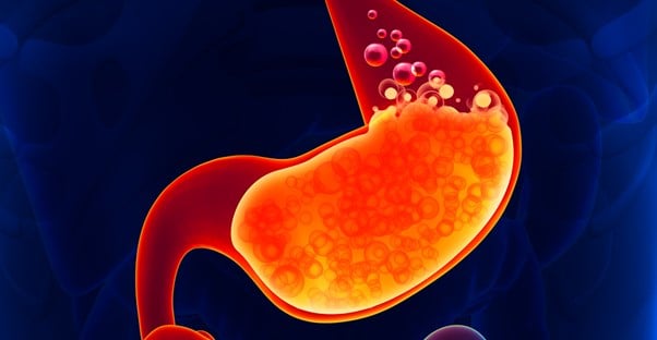 a stomach is being treated for acid reflux