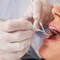What are Dental Caries?