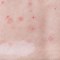 What is Guttate Psoriasis?
