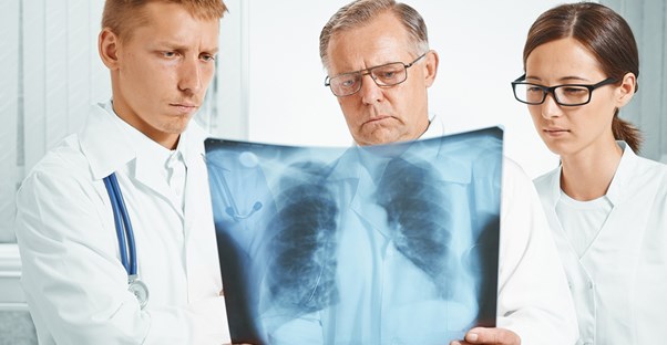 doctors examining pulmonary embolism
