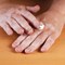 Vitiligo Treatments