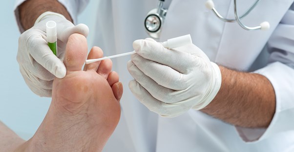 athletes foot treatments