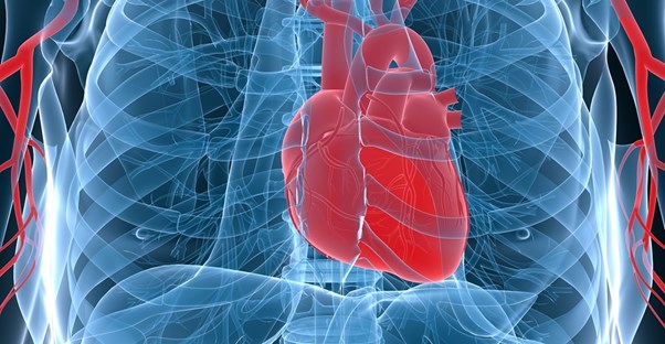 3D imaging can identify acute coronary syndrome causes