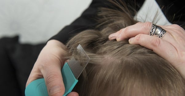 Treatments for head lice