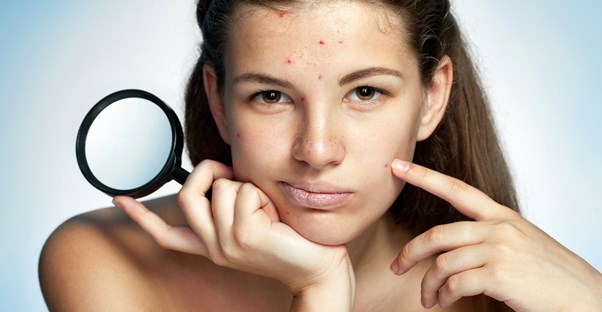 Different types of pimples