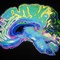 Causes of Obsessive-Compulsive Disorder 