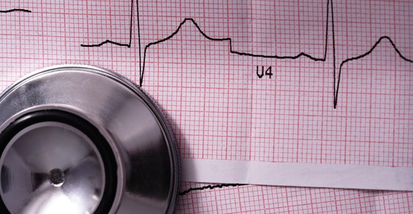 A doctor tests for heart disease