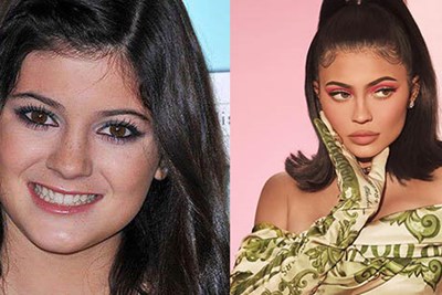 Look How Much These Celebs Have Changed in the Past Decade