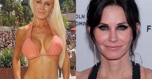 Celebrities Who Reversed Their Cosmetic Procedures main image