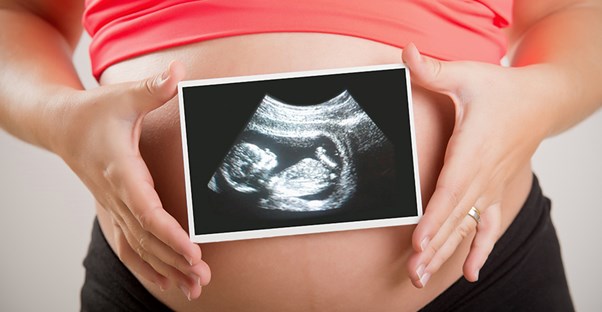A woman holds an ultrasound image of a fetus over her pregnant belly.