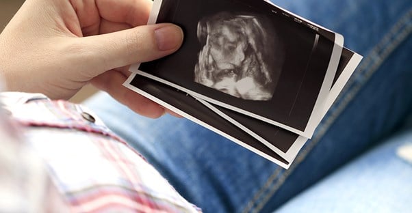 A person holds an assortment of ultrasound images.