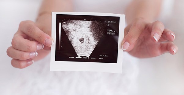 An ultrasound image is held up close to the camera.