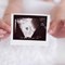 Miscarriage Risk After Age 35