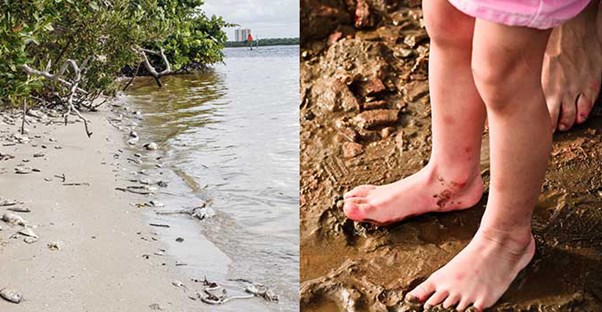 15 Diseases You Can Catch at the Beach  main image