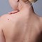When Should You Consider Birthmark Removal?