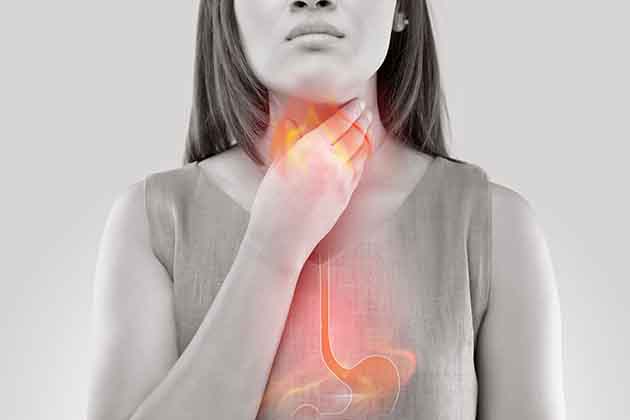 Treat Acid Reflux
