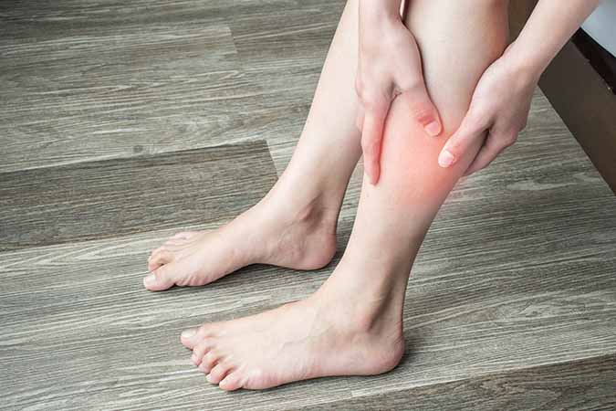 15 Signs You Have A Blood Clot In Your Leg
