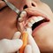 The Best Free Dental Programs of 2023: Check Local Clinics Offering These Programs