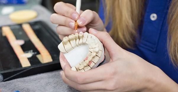 a lab technician who knows which five problems dental veneers won't fix
