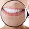 The Dangers of Teeth Whitening